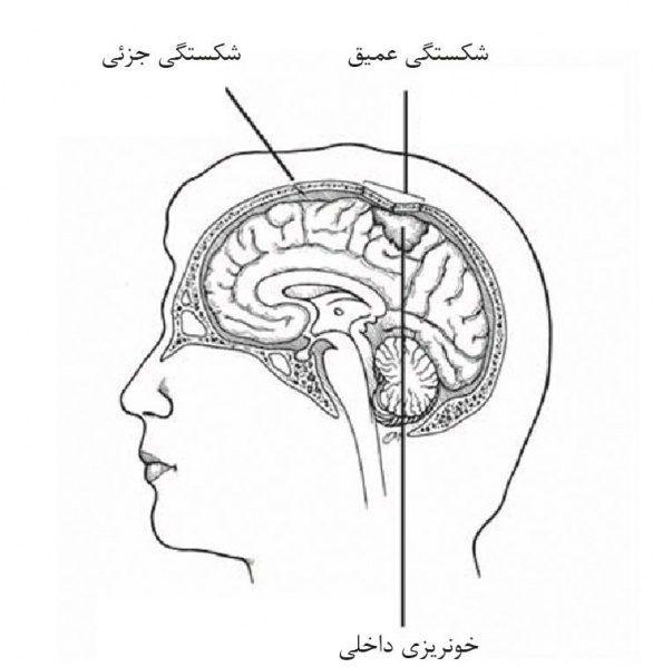 پرونده:28006700.jpg